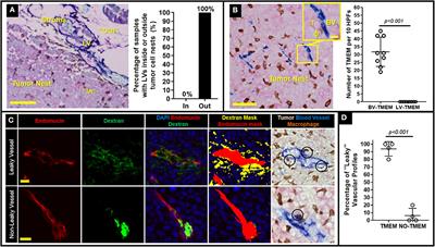 Hematogenous Dissemination of Breast Cancer Cells From Lymph Nodes Is Mediated by Tumor MicroEnvironment of Metastasis Doorways